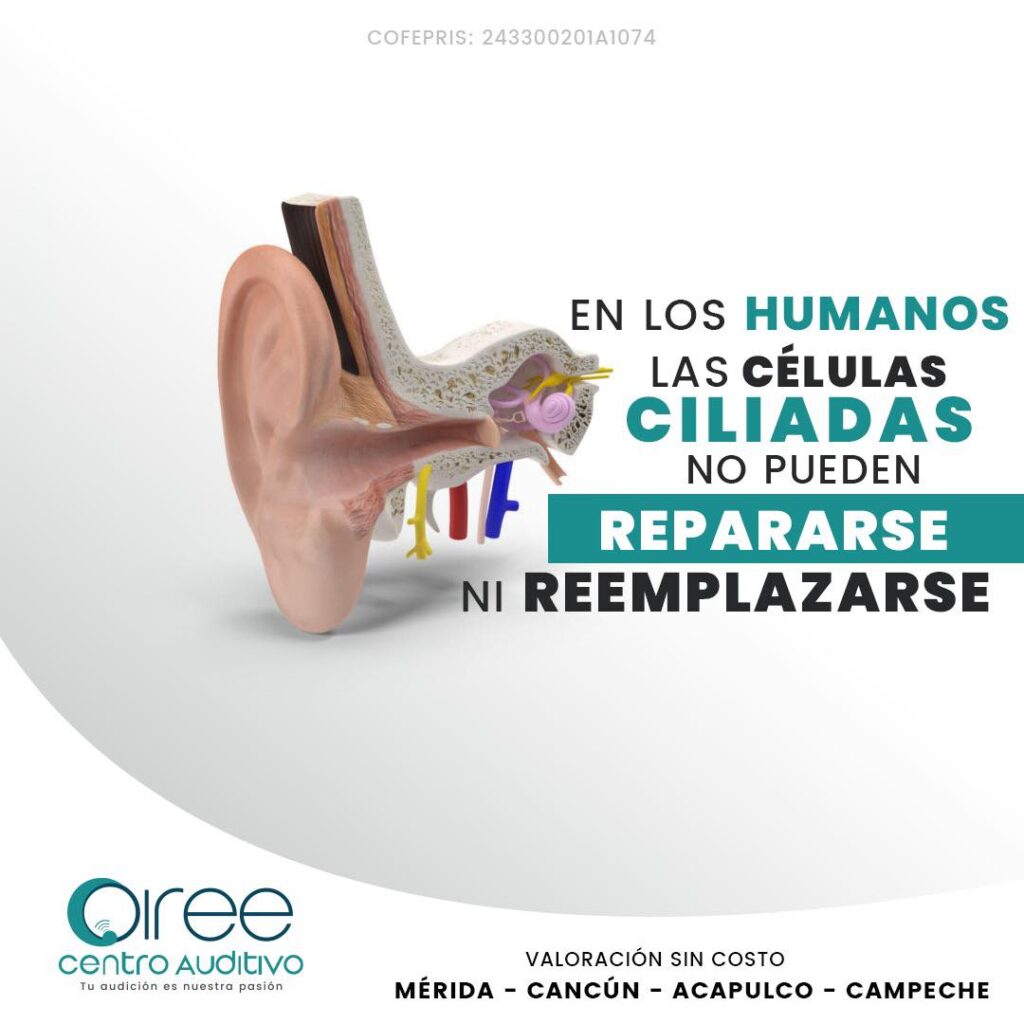 Centro Auditivo Cancún - Auxiliares auditivos 6