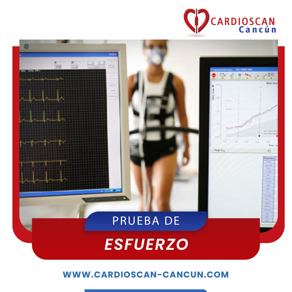 Cardiología en Cancún - CARDIOSCAN